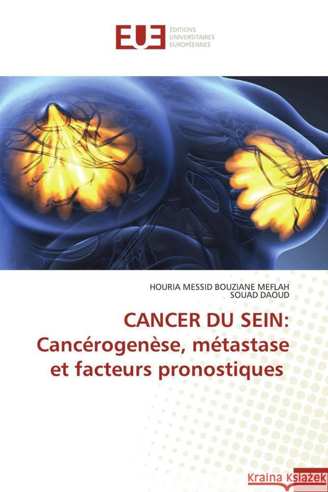 CANCER DU SEIN: Cancérogenèse, métastase et facteurs pronostiques MESSID BOUZIANE MEFLAH, HOURIA, Daoud, Souad 9786206690153