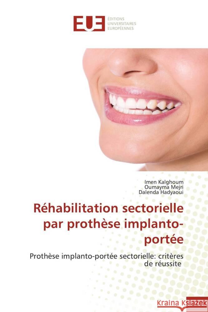 Réhabilitation sectorielle par prothèse implanto-portée Kalghoum, Imen, Mejri, Oumayma, Hadyaoui, Dalenda 9786206691259 Éditions universitaires européennes