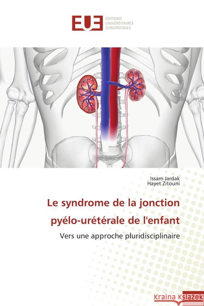 Le syndrome de la jonction pyélo-urétérale de l'enfant JARDAK, Issam, Zitouni, Hayet 9786206694434
