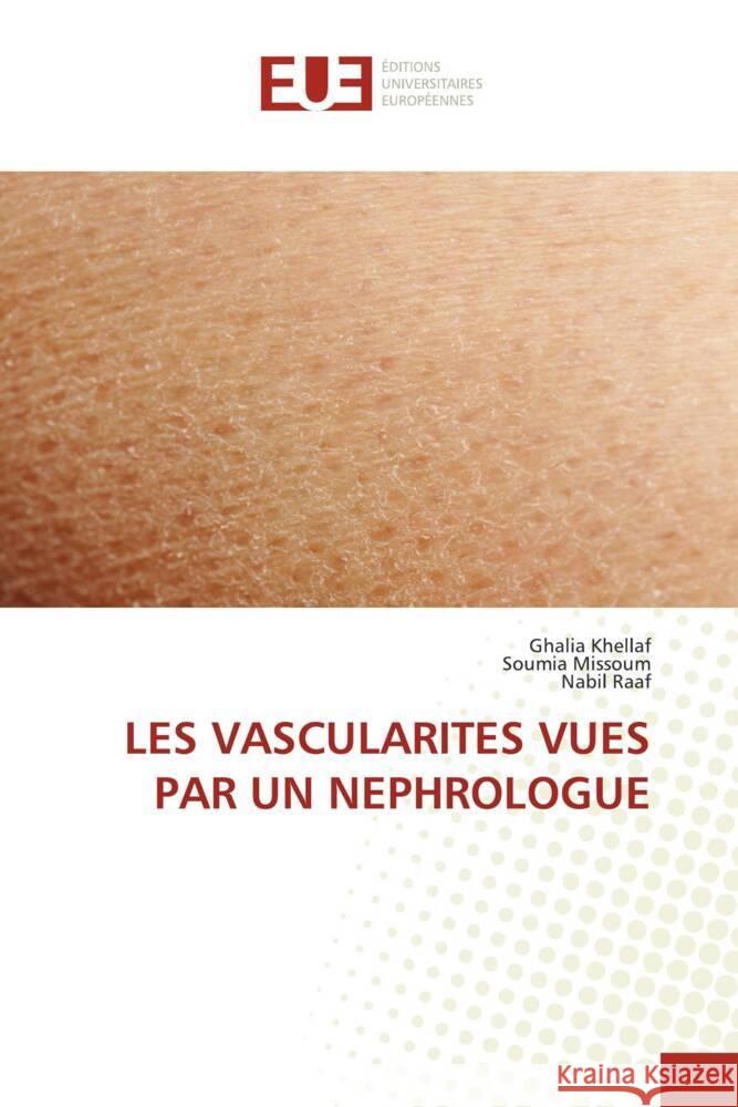 LES VASCULARITES VUES PAR UN NEPHROLOGUE KHELLAF, Ghalia, MISSOUM, Soumia, Raaf, Nabil 9786206697121