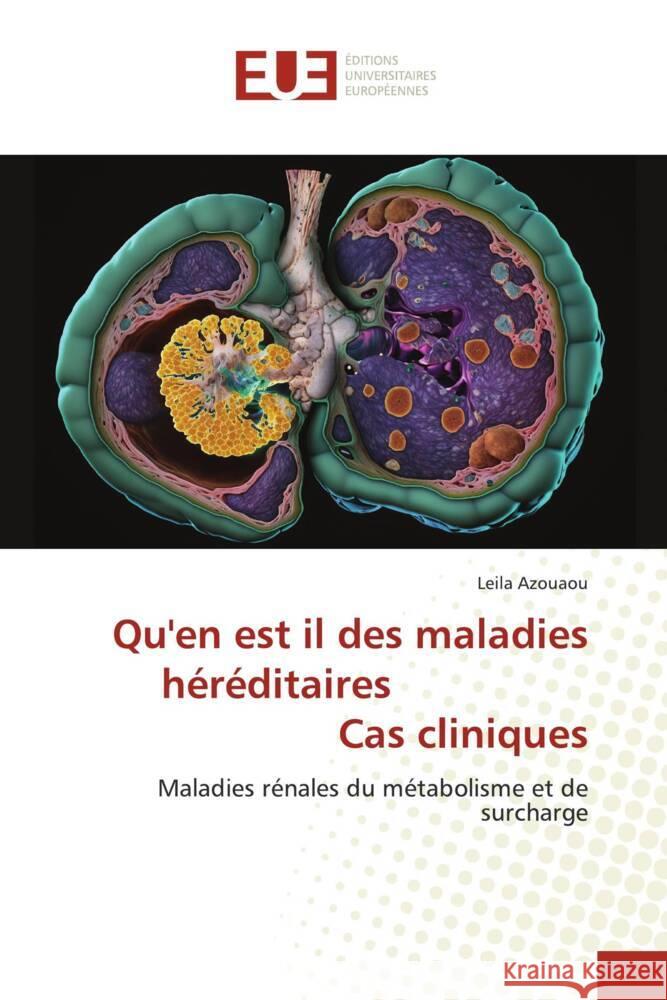 Qu'en est il des maladies héréditaires Cas cliniques Azouaou, Leila 9786206698449