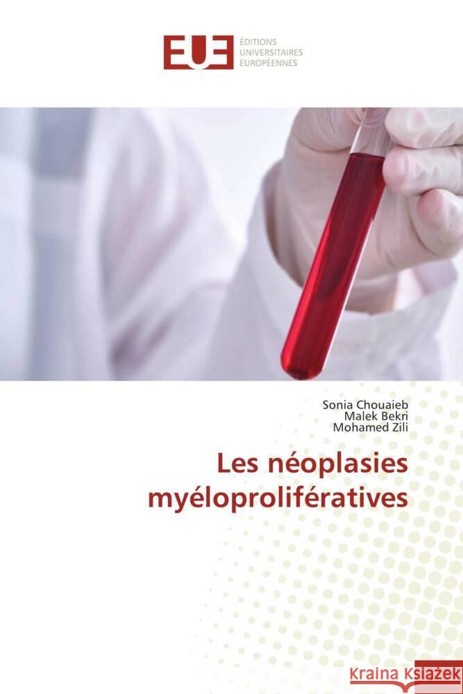 Les néoplasies myéloprolifératives Chouaieb, Sonia, Bekri, Malek, Zili, Mohamed 9786206698494