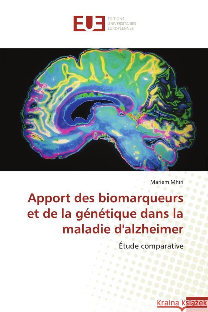 Apport des biomarqueurs et de la g?n?tique dans la maladie d'alzheimer Mariem Mhiri 9786206700371 Editions Universitaires Europeennes