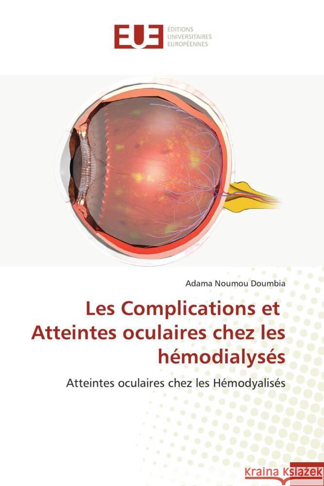 Les Complications et Atteintes oculaires chez les h?modialys?s Adama Noumou Doumbia 9786206700982