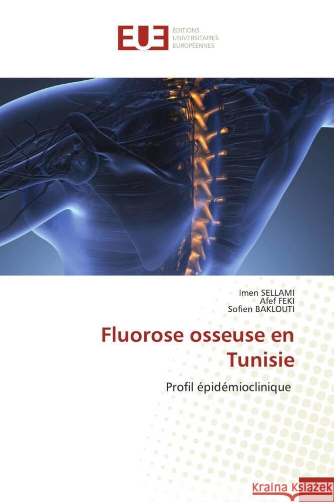 Fluorose osseuse en Tunisie Imen Sellami Afef Feki Sofien Baklouti 9786206701347