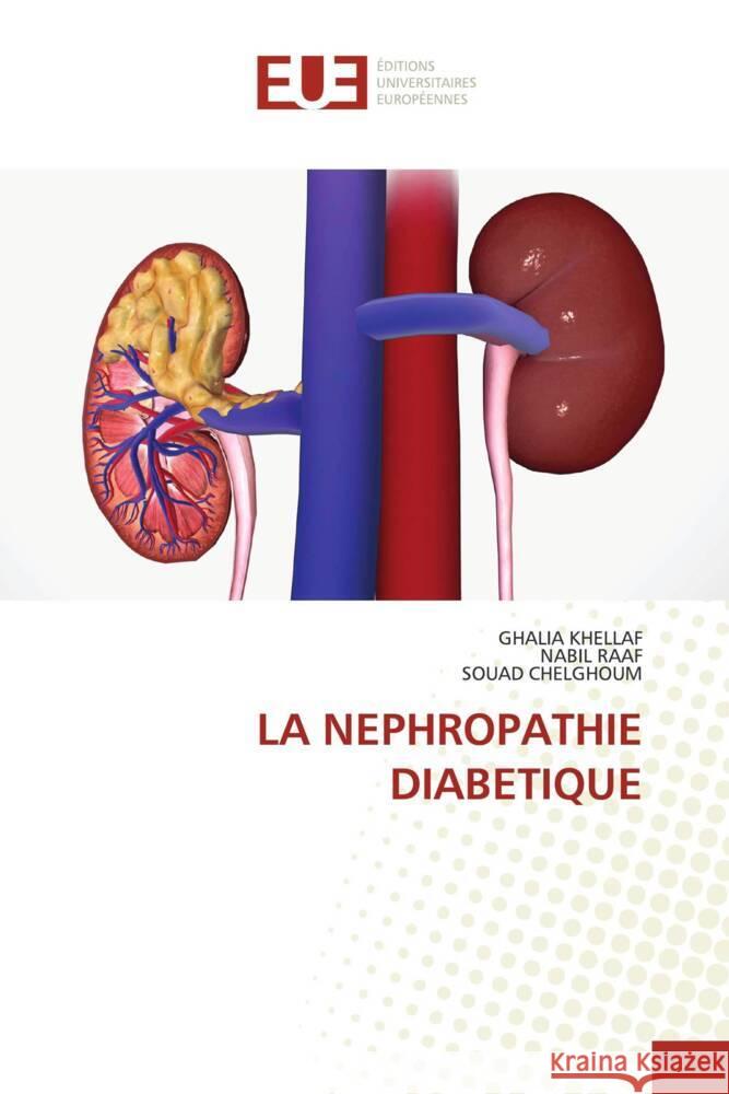 La Nephropathie Diabetique Ghalia Khellaf Nabil Raaf Souad Chelghoum 9786206702078