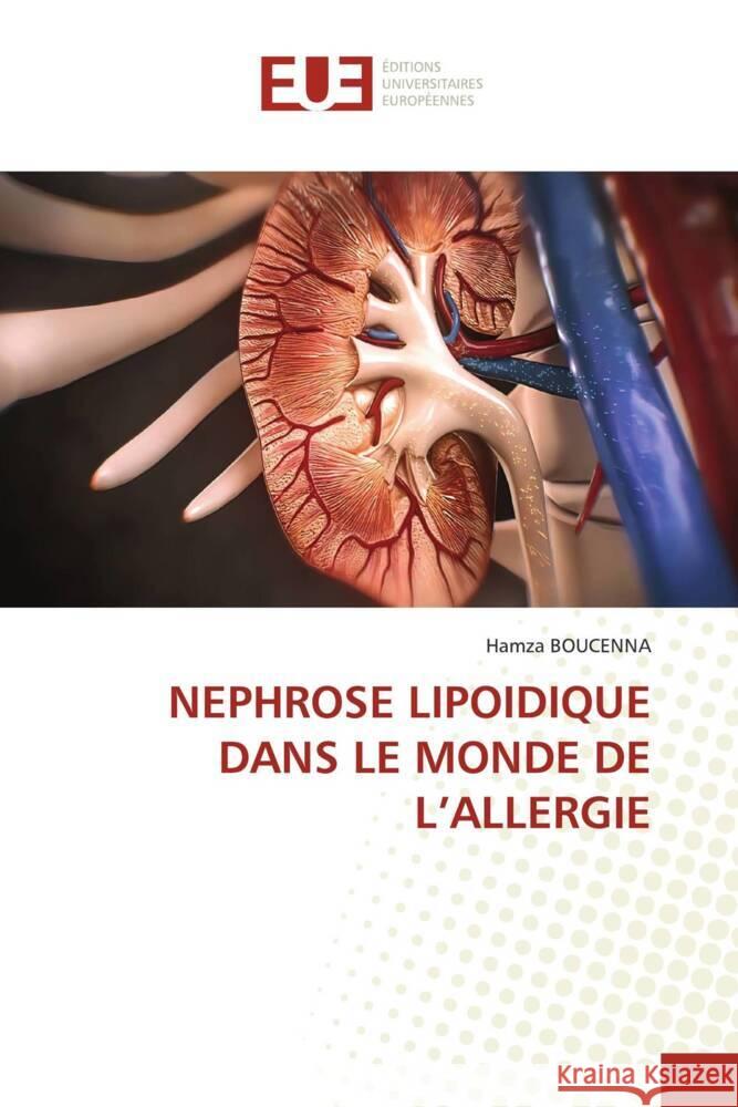 Nephrose Lipoidique Dans Le Monde de l'Allergie Hamza Boucenna 9786206702788