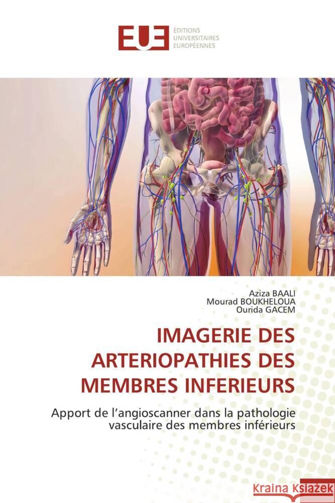 Imagerie Des Arteriopathies Des Membres Inferieurs Aziza Baali Mourad Boukheloua Ourida Gacem 9786206707738 Editions Universitaires Europeennes