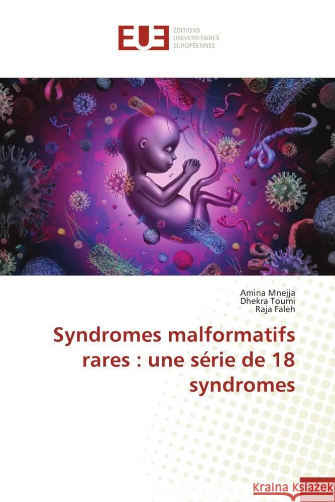 Syndromes malformatifs rares: une s?rie de 18 syndromes Amina Mnejja Dhekra Toumi Raja Faleh 9786206709299