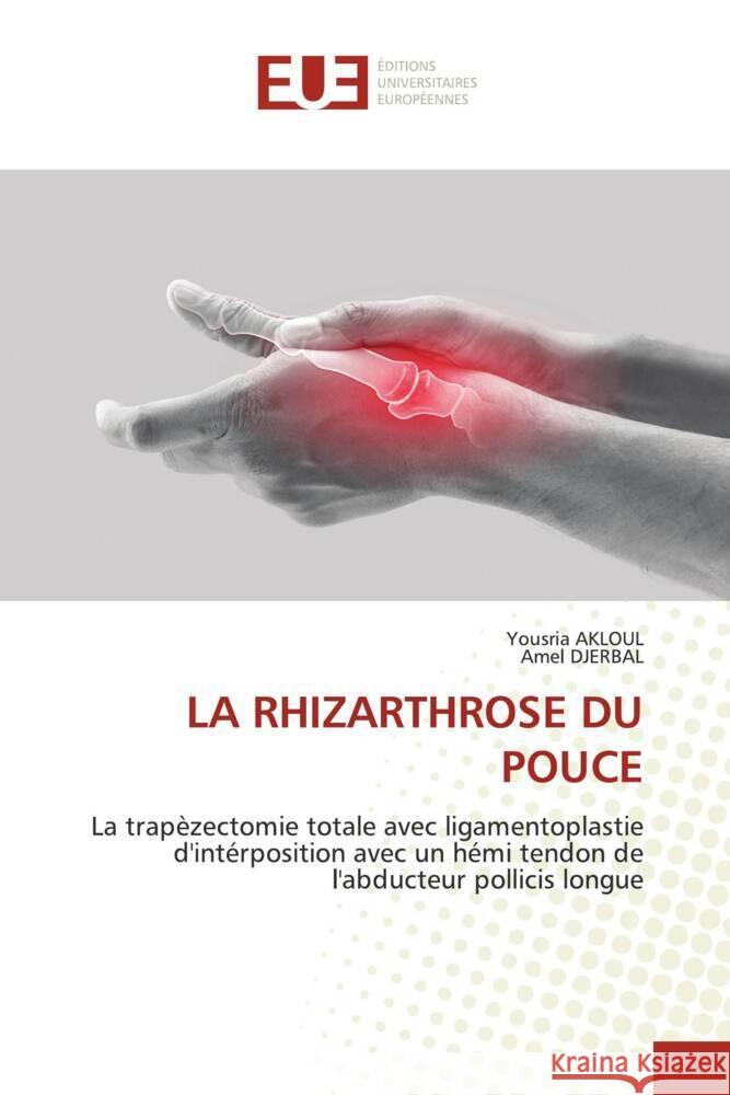 La Rhizarthrose Du Pouce Yousria Akloul Amel Djerbal 9786206711452