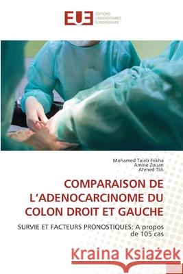 Comparaison de l'Adenocarcinome Du Colon Droit Et Gauche Mohamed Taieb Frikha Amine Zouari Ahmed Tlili 9786206714835 Editions Universitaires Europeennes