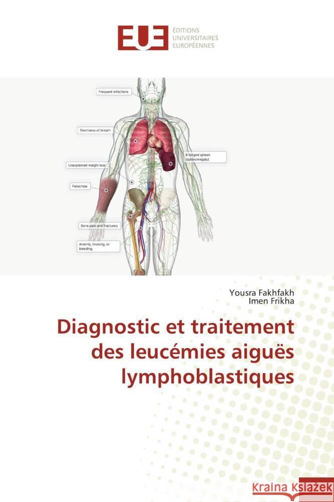 Diagnostic et traitement des leucémies aiguës lymphoblastiques Fakhfakh, Yousra, Frikha, Imen 9786206722038