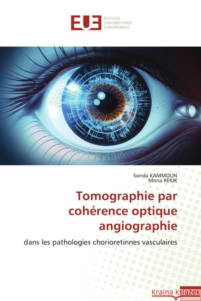 Tomographie par cohérence optique angiographie KAMMOUN, Sonda, REKIK, Mona 9786206722120