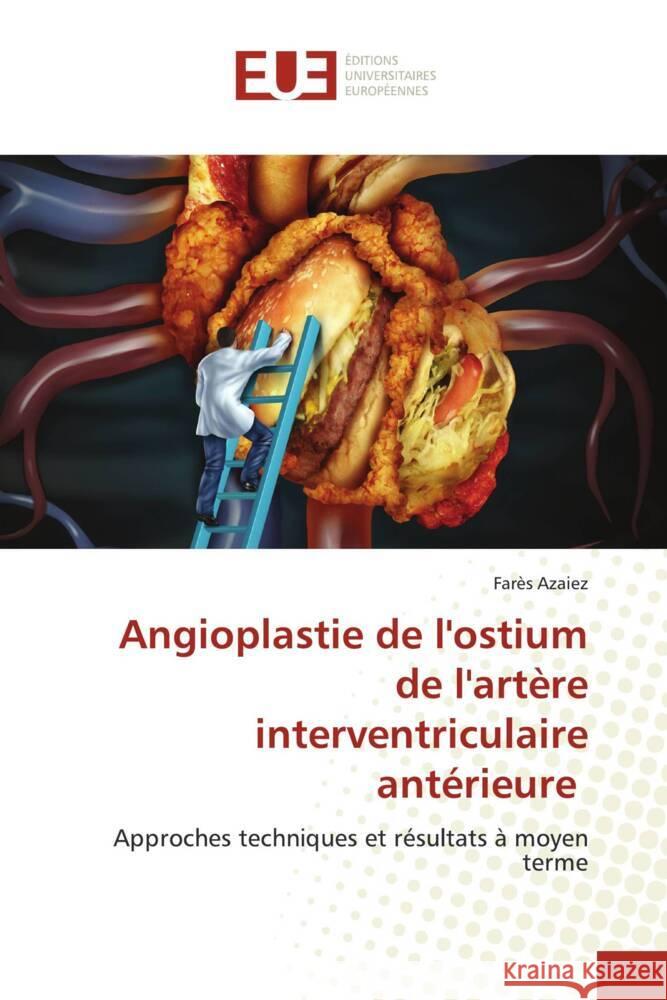 Angioplastie de l'ostium de l'artère interventriculaire antérieure Azaiez, Farès 9786206724711