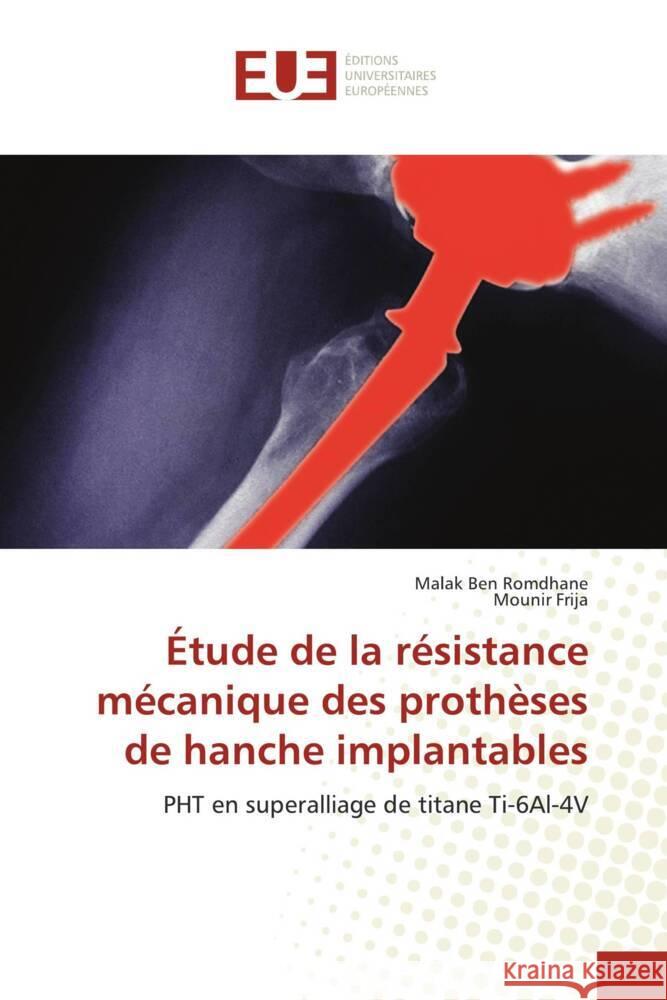 ?tude de la r?sistance m?canique des proth?ses de hanche implantables Malak Be Mounir Frija 9786206726296