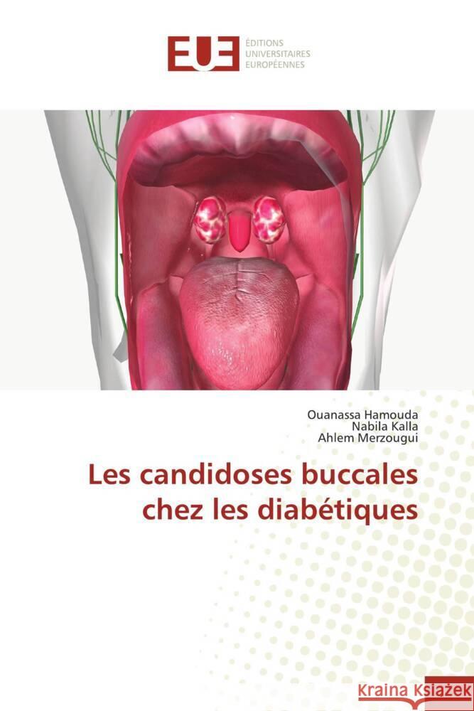 Les candidoses buccales chez les diabétiques Hamouda, Ouanassa, Kalla, Nabila, Merzougui, Ahlem 9786206728269