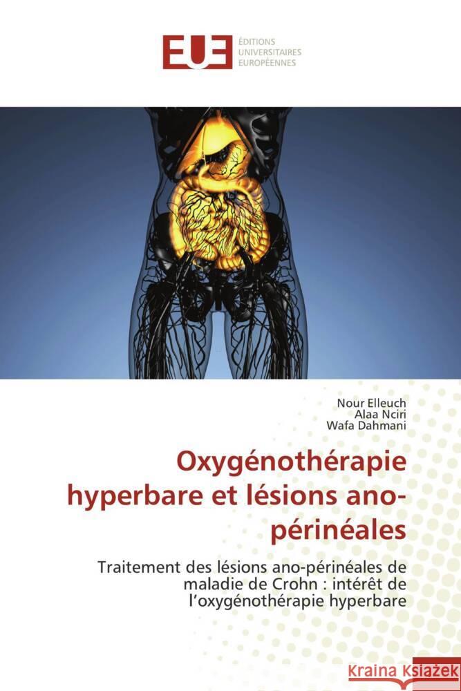 Oxygénothérapie hyperbare et lésions ano-périnéales Elleuch, Nour, Nciri, Alaa, Dahmani, Wafa 9786206730583