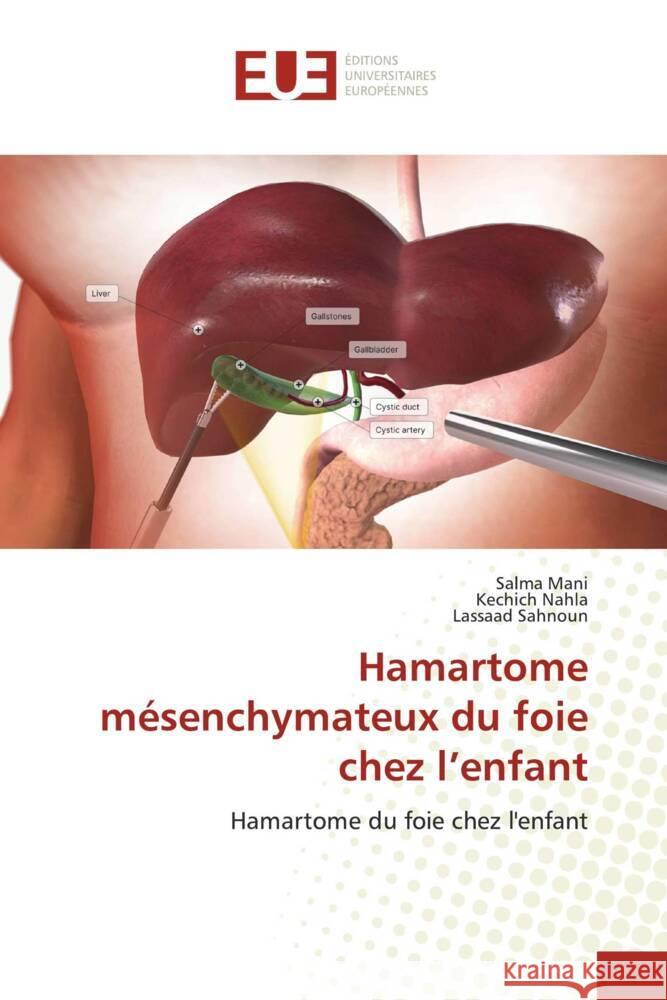 Hamartome mésenchymateux du foie chez l'enfant Mani, Salma, Nahla, Kechich, Sahnoun, Lassaad 9786206732129