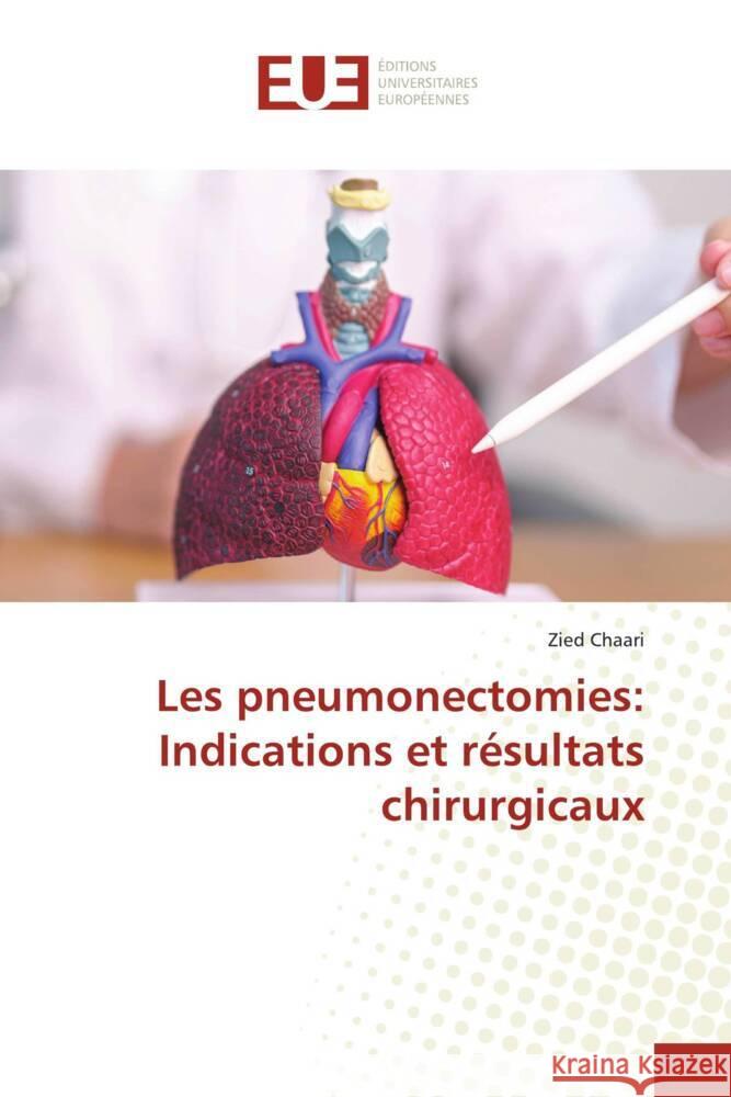 Les pneumonectomies: Indications et résultats chirurgicaux Chaari, Zied 9786206732440