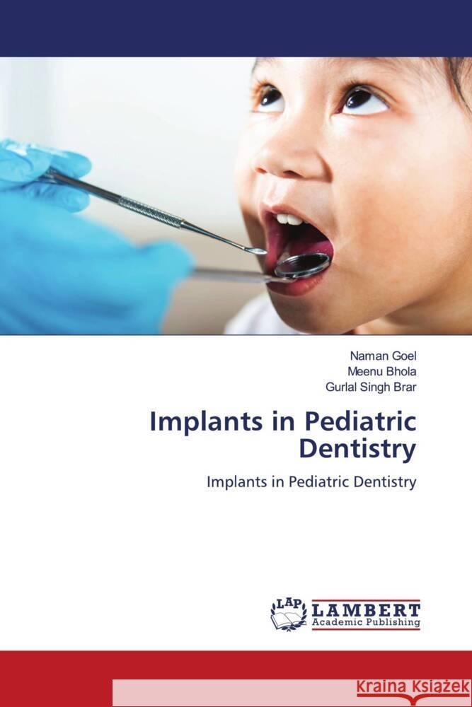 Implants in Pediatric Dentistry Goel, Naman, Bhola, Meenu, Brar, Gurlal Singh 9786206736899