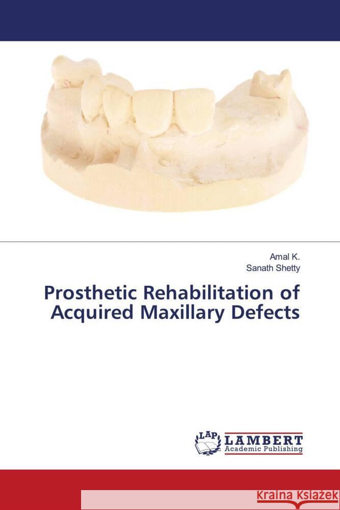 Prosthetic Rehabilitation of Acquired Maxillary Defects K., Amal, Shetty, Sanath 9786206738725