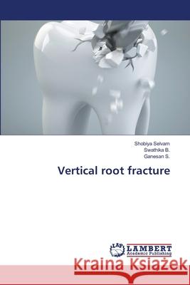 Vertical root fracture Selvam, Shobiya, B., Swathika, S., Ganesan 9786206740285 LAP Lambert Academic Publishing