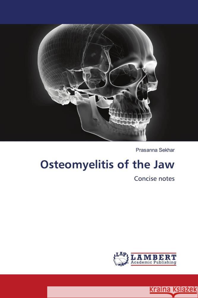 Osteomyelitis of the Jaw Sekhar, Prasanna 9786206752240