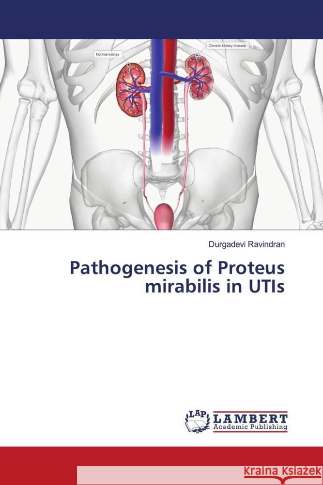 Pathogenesis of Proteus mirabilis in UTIs Ravindran, Durgadevi 9786206753872