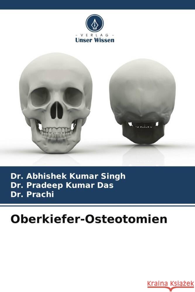 Oberkiefer-Osteotomien Singh, Dr. Abhishek Kumar, Das, Dr. Pradeep Kumar, Prachi, Dr. 9786206764632 Verlag Unser Wissen
