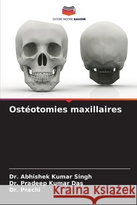 Ostéotomies maxillaires Singh, Dr. Abhishek Kumar, Das, Dr. Pradeep Kumar, Prachi, Dr. 9786206764663