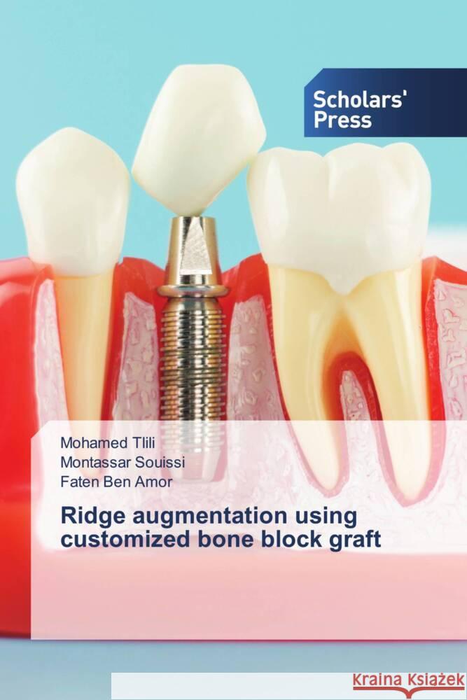 Ridge augmentation using customized bone block graft Tlili, Mohamed, Souissi, Montassar, Ben Amor, Faten 9786206768777 Scholars' Press