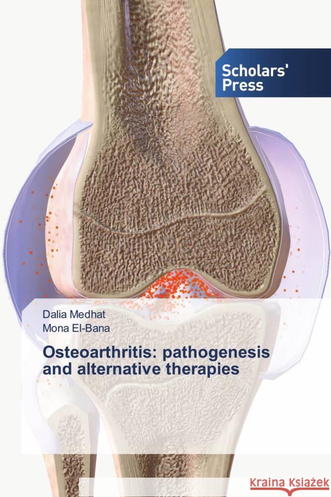 Osteoarthritis: pathogenesis and alternative therapies Medhat, Dalia, El-Bana, Mona 9786206768968