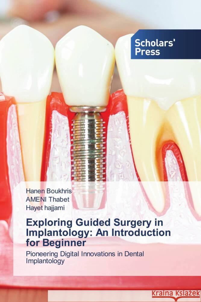 Exploring Guided Surgery in Implantology: An Introduction for Beginner Hanen Boukhris Ameni Thabet Hayet Hajjami 9786206771630