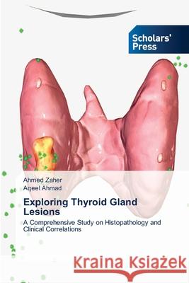 Exploring Thyroid Gland Lesions Ahmed Zaher Aqeel Ahmad 9786206772415