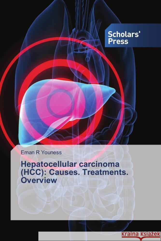 Hepatocellular carcinoma (HCC): Causes. Treatments. Overview Eman R. Youness 9786206774617