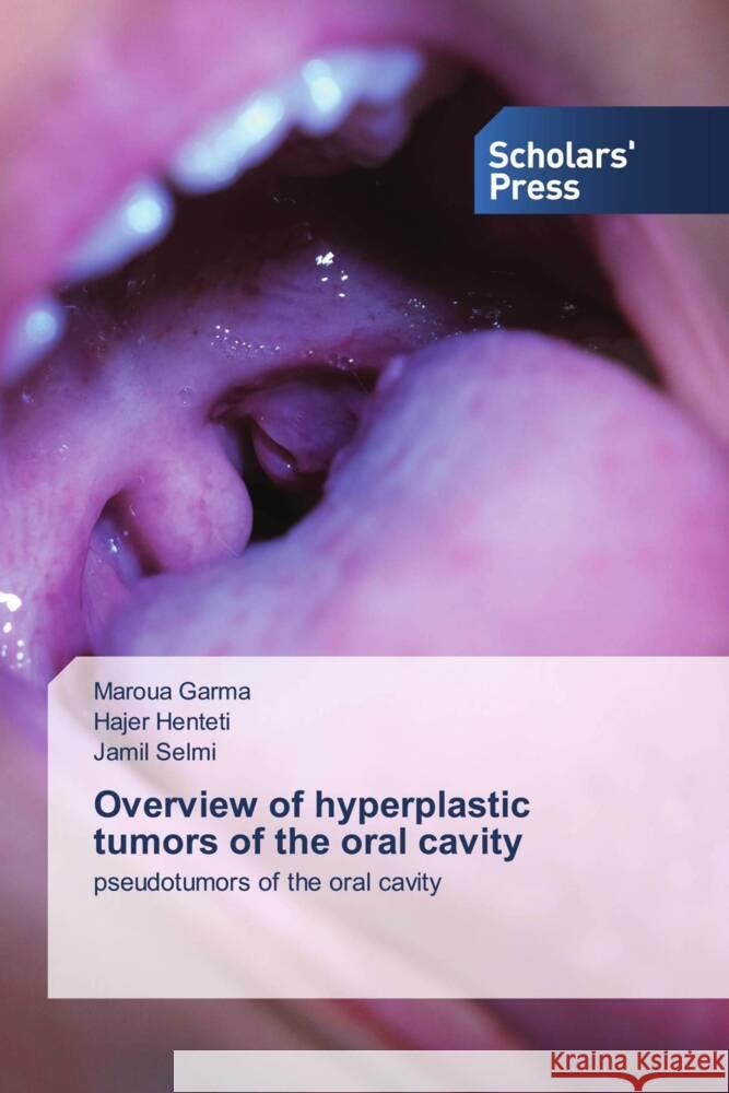 Overview of hyperplastic tumors of the oral cavity Maroua Garma Hajer Henteti Jamil Selmi 9786206774709