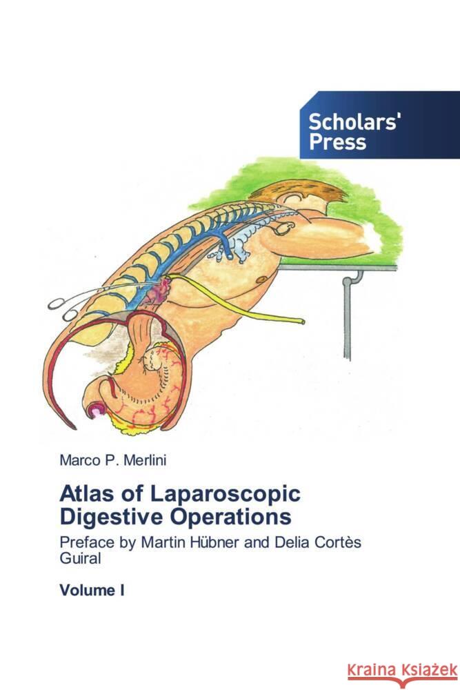 Atlas of Laparoscopic Digestive Operations Marco P. Merlini 9786206774754