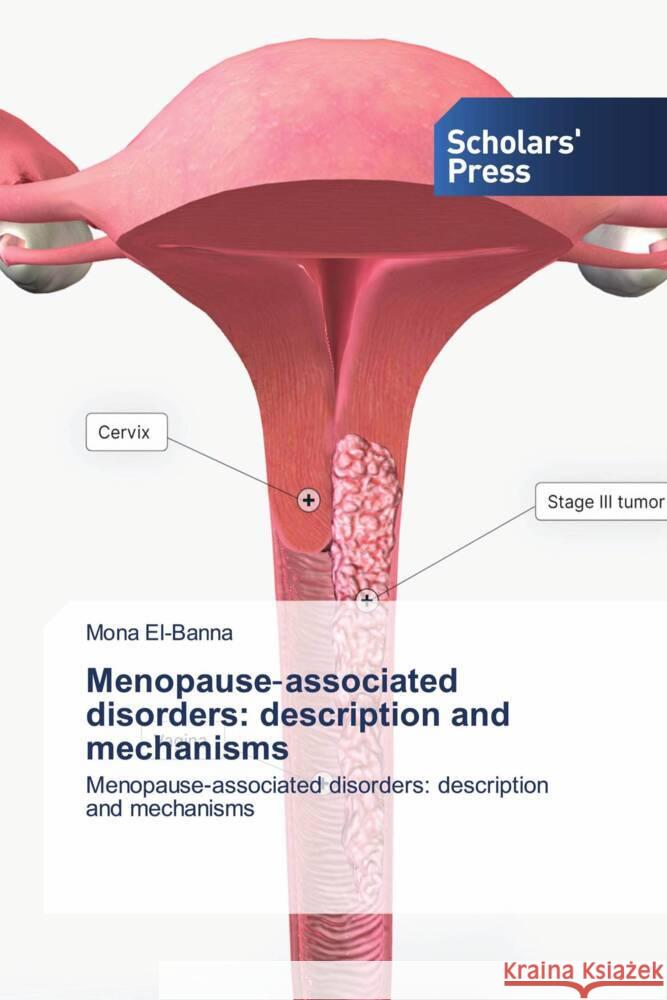 Menopause-associated disorders: description and mechanisms El-Banna, Mona 9786206775164