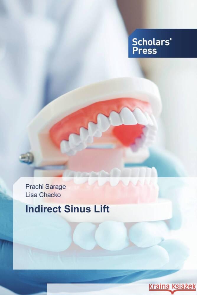 Indirect Sinus Lift Prachi Sarage Lisa Chacko 9786206775300