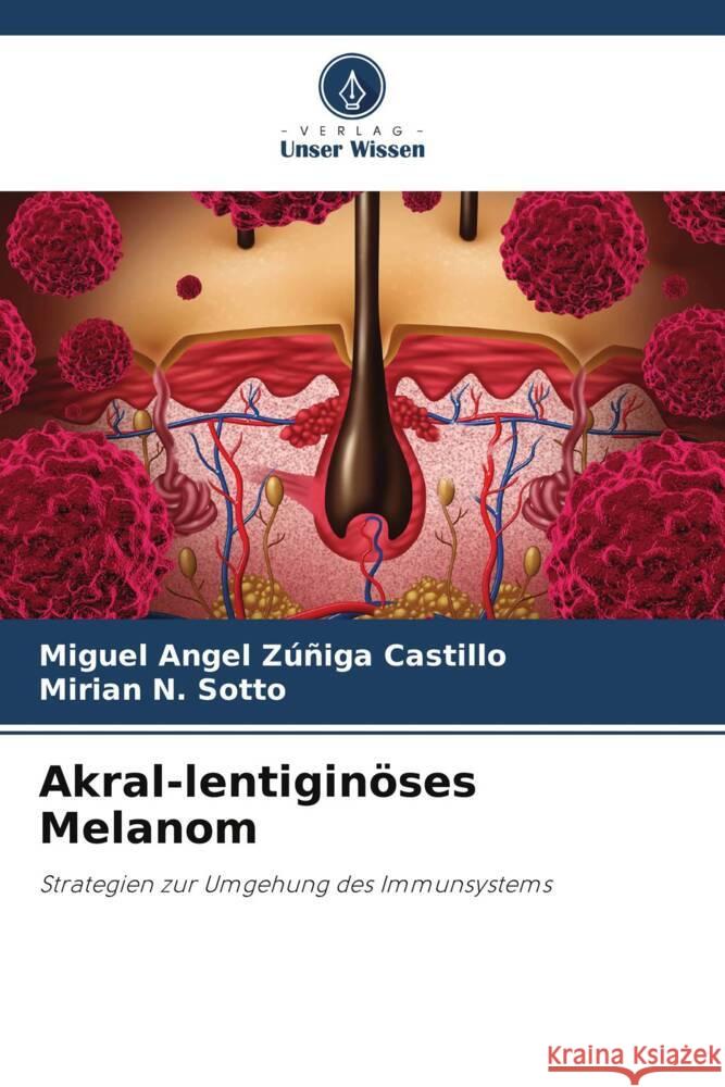 Akral-lentiginöses Melanom Zúñiga Castillo, Miguel Angel, N. Sotto, Mirian 9786206776437