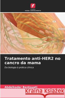 Tratamento anti-HER2 no cancro da mama Bentouati, Abdelkader 9786206777588 Edições Nosso Conhecimento