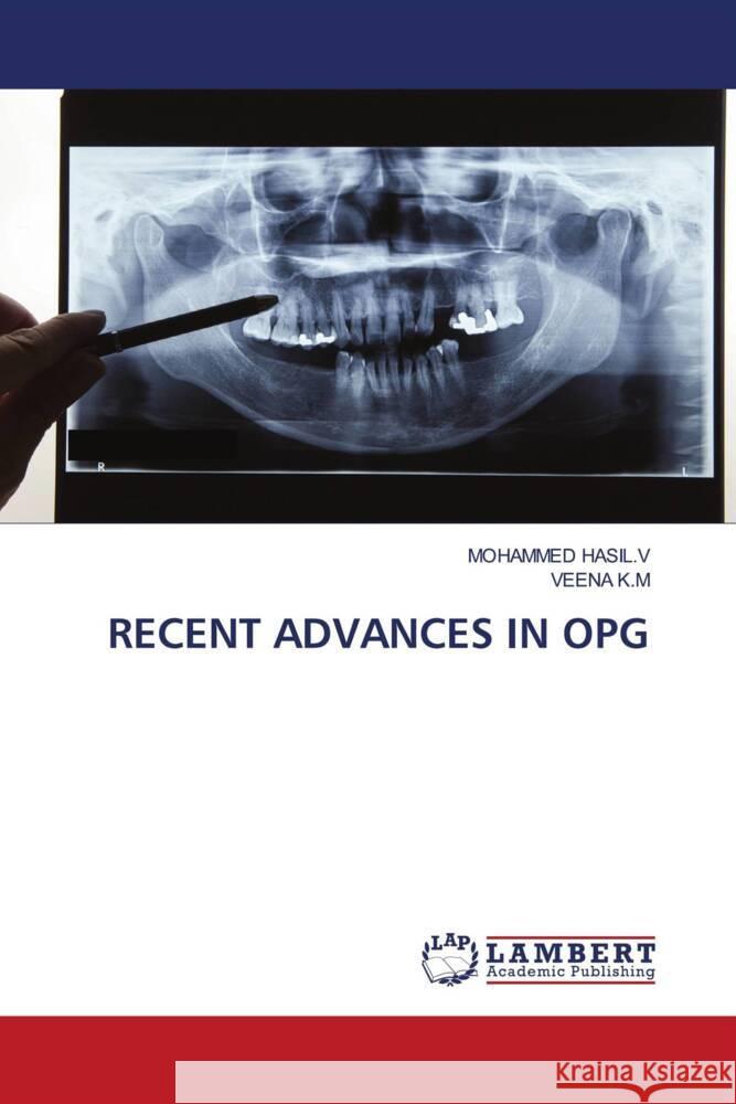 RECENT ADVANCES IN OPG HASIL.V, MOHAMMED, K.M, VEENA 9786206779117 LAP Lambert Academic Publishing