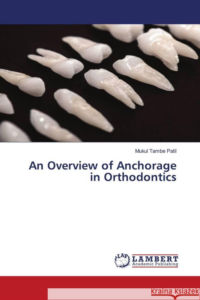 An Overview of Anchorage in Orthodontics Tambe Patil, Mukul 9786206780465