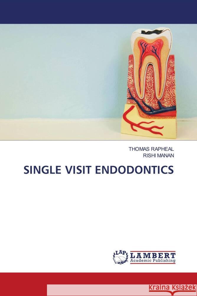 SINGLE VISIT ENDODONTICS RAPHEAL, THOMAS, Manan, Rishi 9786206780885