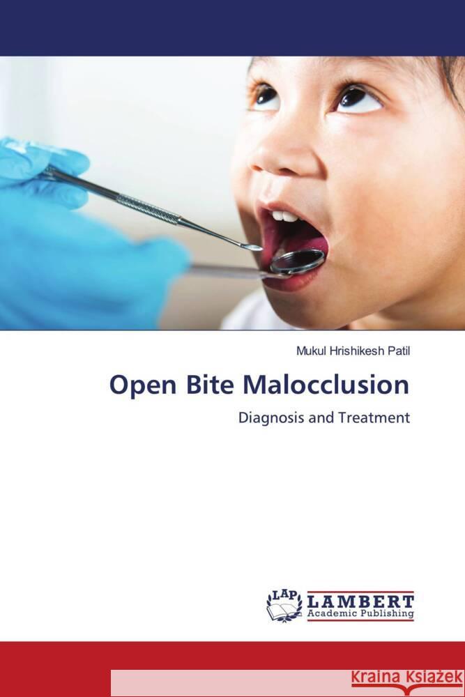 Open Bite Malocclusion Patil, Mukul Hrishikesh 9786206781653