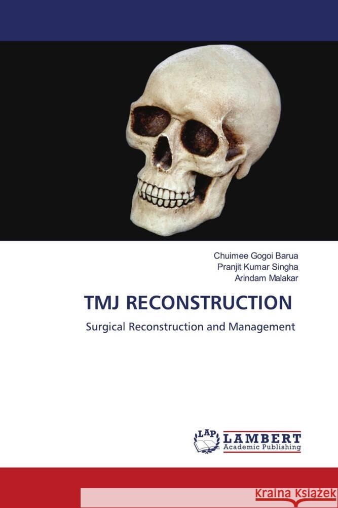 TMJ RECONSTRUCTION Barua, Chuimee Gogoi, Singha, Pranjit Kumar, Malakar, Arindam 9786206785149 LAP Lambert Academic Publishing