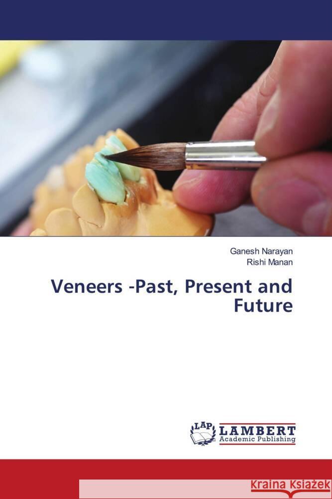 Veneers -Past, Present and Future Narayan, Ganesh, Manan, Rishi 9786206785651