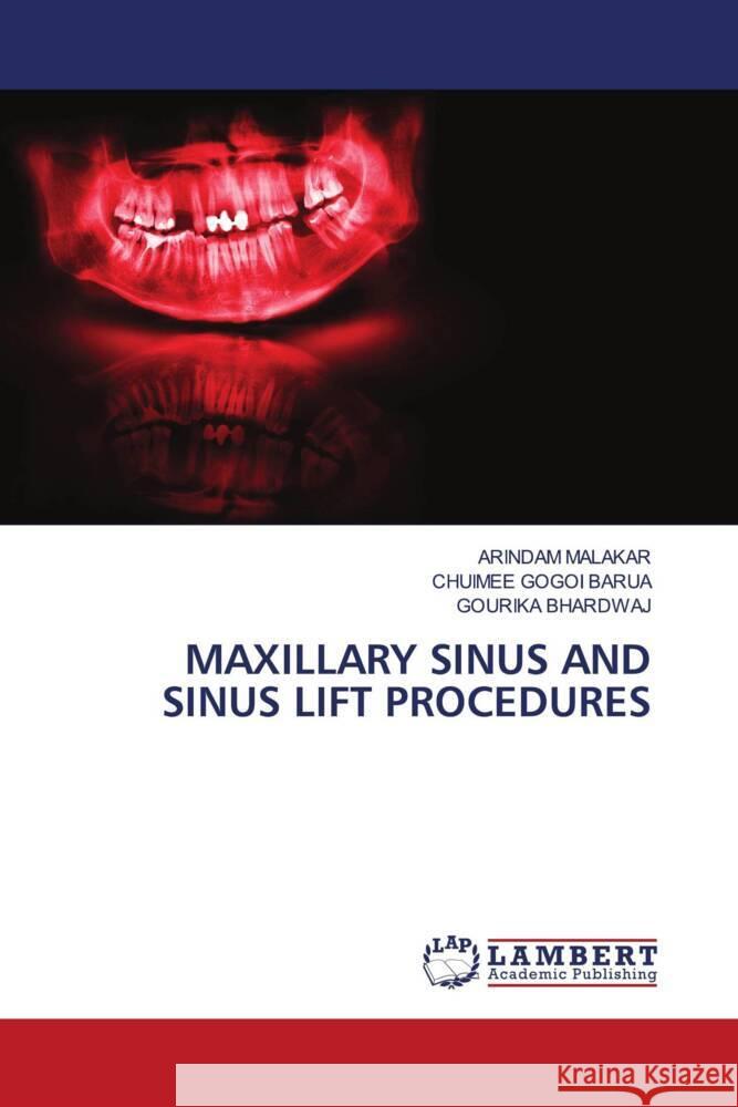 MAXILLARY SINUS AND SINUS LIFT PROCEDURES Malakar, Arindam, Barua, Chuimee Gogoi, BHARDWAJ, GOURIKA 9786206786191 LAP Lambert Academic Publishing