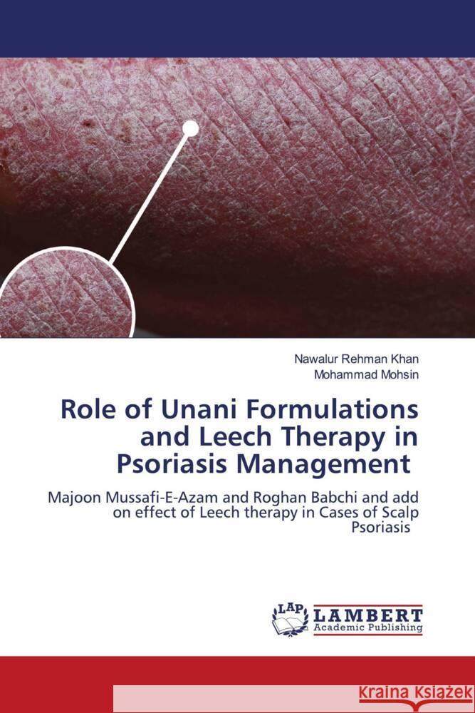 Role of Unani Formulations and Leech Therapy in Psoriasis Management Nawalur Rehman Khan Mohammad Mohsin 9786206788799