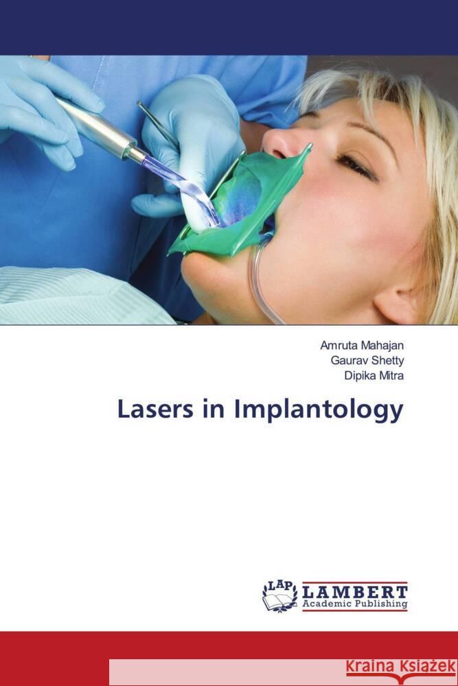 Lasers in Implantology Mahajan, Amruta, Shetty, Gaurav, Mitra, Dipika 9786206788898